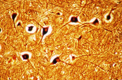 Neurones